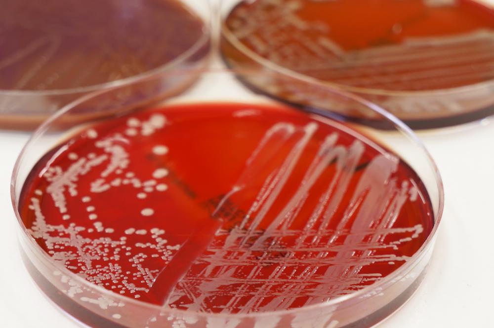 Shutterstock Red agar petri dish microbiology